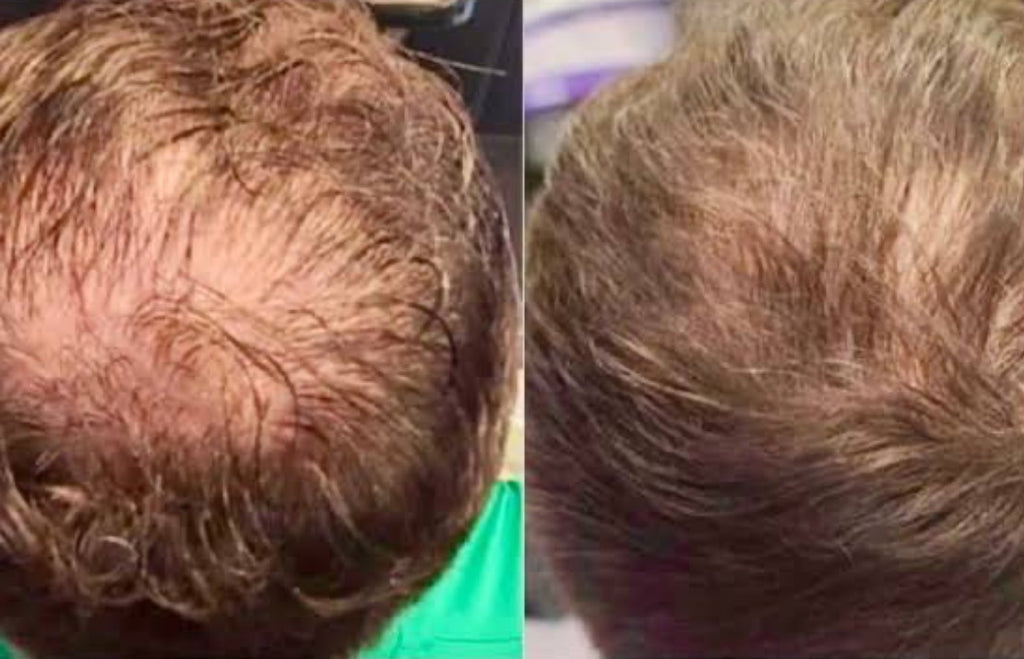 Procell Hair Care Serum with Stem Cell Cytokines and Growth Factors